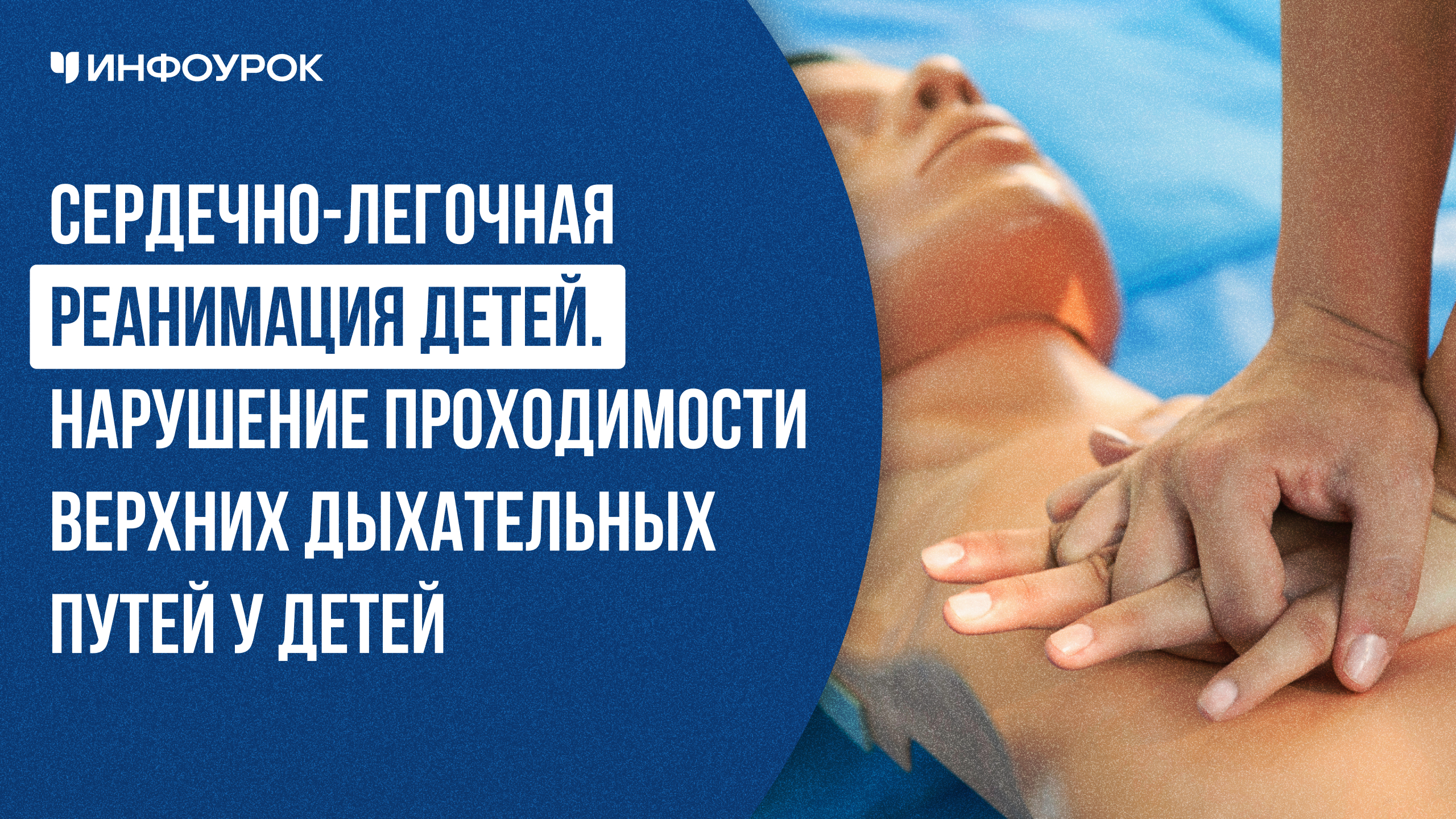 Сердечно-легочная реанимация детей. Нарушение проходимости верхних дыхательных путей у детей