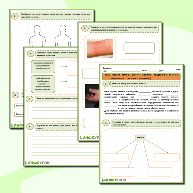 Рабочий лист ОБЖ- «Первая помощь при ожогах»
