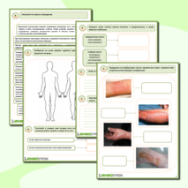 Рабочий лист ОБЖ- «Первая помощь при ожогах»